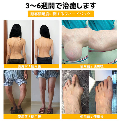 ZUWIAY® ハチ毒配合 痛み緩和・骨の治癒クリーム 🎊🎊（特に高齢者向け）