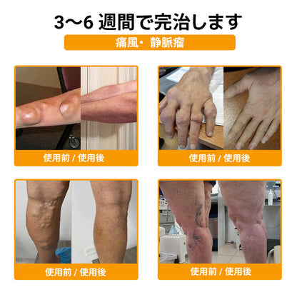 ZUWIAY® ハチ毒配合 痛み緩和・骨の治癒クリーム 🎊🎊（特に高齢者向け）