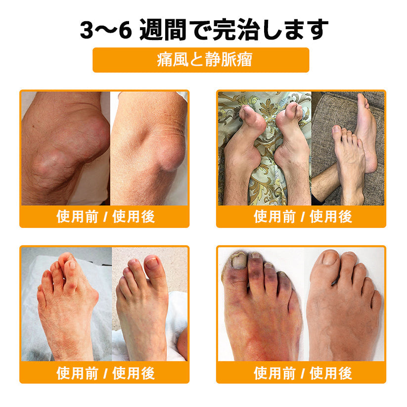 ZUWIAY® ハチ毒配合 痛み緩和・骨の治癒クリーム 🎊🎊（特に高齢者向け）